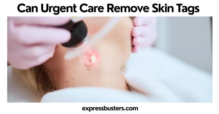Can Urgent Care Remove Skin Tags