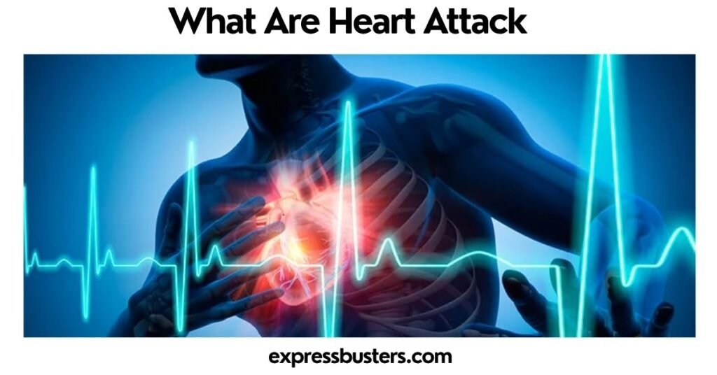 What Are Heart Attack
