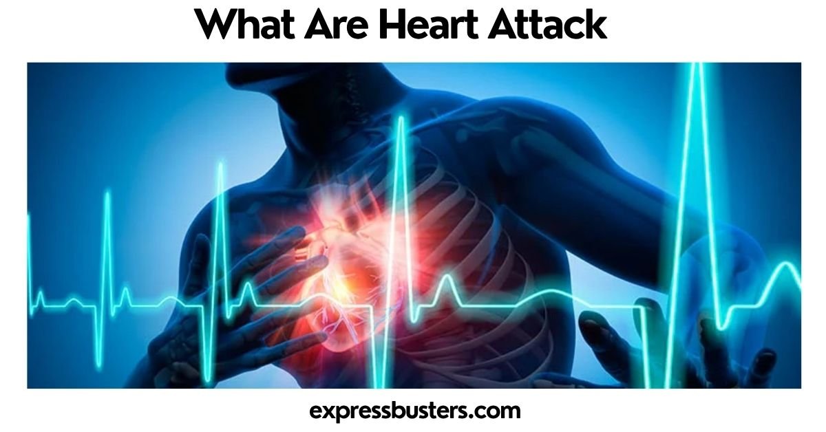 What Are Heart Attack