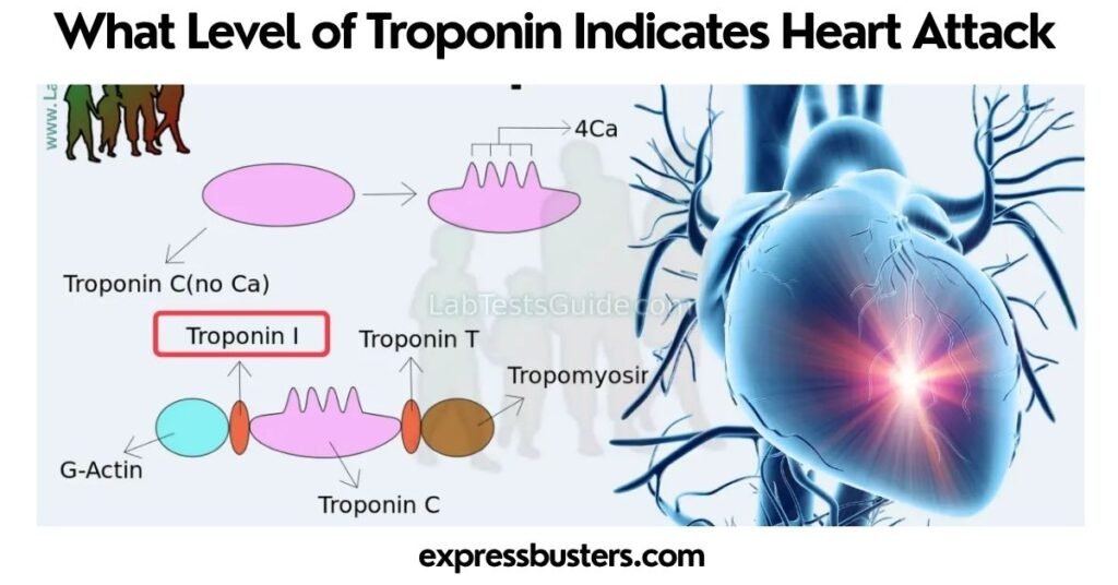 What Level of Troponin Indicates Heart Attack