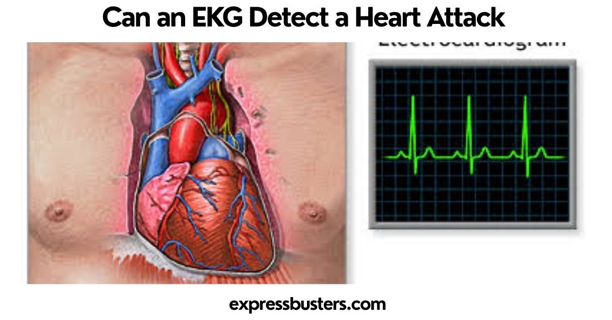 Can an EKG Detect a Heart Attack